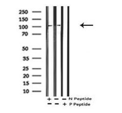 Invitrogen Phospho-EphA2 (Thr587) Polyclonal Antibody 100 &mu;L; Unconjugated:Antibodies,