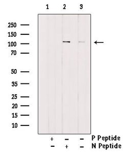 Invitrogen Phospho-EphA2 (Thr587) Polyclonal Antibody 100 &mu;L; Unconjugated:Antibodies,
