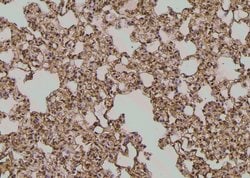Invitrogen Phospho-EphA2 (Ser901) Polyclonal Antibody 100 &mu;L; Unconjugated:Antibodies,