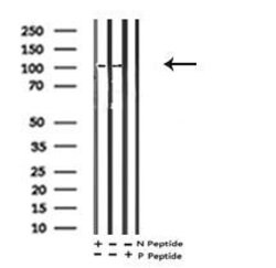 Invitrogen Phospho-EphA2 (Ser901) Polyclonal Antibody 100 &mu;L; Unconjugated:Antibodies,