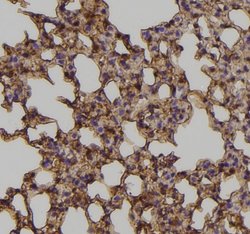 Invitrogen Phospho-EphA3 (Tyr779) Polyclonal Antibody 100 &mu;L; Unconjugated:Antibodies,
