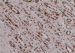 Invitrogen Phospho-TYK2 (Tyr433) Polyclonal Antibody 100 &mu;L; Unconjugated:Antibodies,