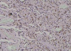 Invitrogen Phospho-MARCKS (Ser170) Polyclonal Antibody 100 &mu;L; Unconjugated:Antibodies,