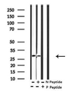 Invitrogen Phospho-MARCKS (Ser170) Polyclonal Antibody 100 &mu;L; Unconjugated:Antibodies,