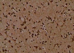 Invitrogen Phospho-Axl (Tyr703) Polyclonal Antibody 100 &mu;L; Unconjugated:Antibodies,