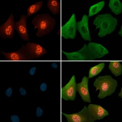 Invitrogen Phospho-MCM4 (Ser88) Polyclonal Antibody 100 μL; Unconjugated:Antibodies,