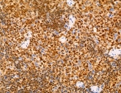 Invitrogen Phospho-FLT3 (Tyr631) Polyclonal Antibody 100 &mu;L; Unconjugated:Antibodies,