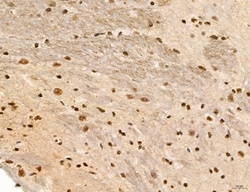 Invitrogen Phospho-FLT3 (Tyr631) Polyclonal Antibody 100 &mu;L; Unconjugated:Antibodies,