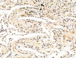 Invitrogen Phospho-FLT3 (Tyr631) Polyclonal Antibody 100 &mu;L; Unconjugated:Antibodies,