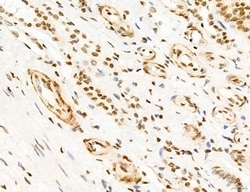 Invitrogen Phospho-FLT3 (Tyr631) Polyclonal Antibody 100 &mu;L; Unconjugated:Antibodies,