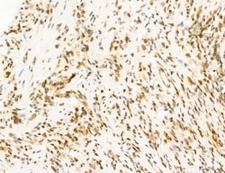 Invitrogen Phospho-FLT3 (Tyr631) Polyclonal Antibody 100 &mu;L; Unconjugated:Antibodies,