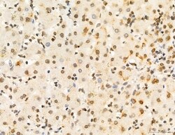 Invitrogen Phospho-FLT3 (Tyr631) Polyclonal Antibody 100 &mu;L; Unconjugated:Antibodies,