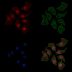 Invitrogen Phospho-STAT3 (Tyr539) Polyclonal Antibody 100 &mu;L | Buy Online | Invitrogen&trade; | Fisher Scientific
