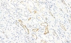 Invitrogen Phospho-STAT3 (Tyr539) Polyclonal Antibody 100 &mu;L | Buy Online | Invitrogen&trade; | Fisher Scientific