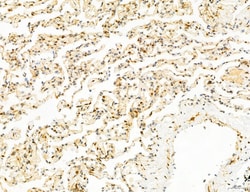 Invitrogen Phospho-mTOR (Ser2454) Polyclonal Antibody 100 &mu;L; Unconjugated:Antibodies,