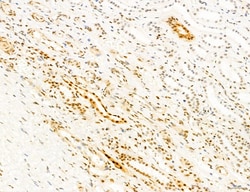 Invitrogen Phospho-mTOR (Ser2454) Polyclonal Antibody 100 &mu;L; Unconjugated:Antibodies,