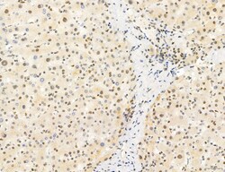Invitrogen Phospho-mTOR (Ser2454) Polyclonal Antibody 100 &mu;L; Unconjugated:Antibodies,