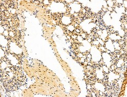 Invitrogen Phospho-mTOR (Ser2454) Polyclonal Antibody 100 &mu;L; Unconjugated:Antibodies,