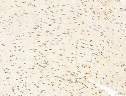 Invitrogen Phospho-mTOR (Ser2454) Polyclonal Antibody 100 &mu;L; Unconjugated:Antibodies,