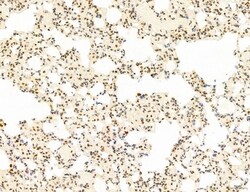 Invitrogen Phospho-mTOR (Ser2454) Polyclonal Antibody 100 &mu;L; Unconjugated:Antibodies,