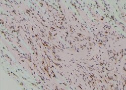 Invitrogen Phospho-mTOR (Ser2454) Polyclonal Antibody 100 &mu;L; Unconjugated:Antibodies,