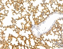 Invitrogen Phospho-WASP (Tyr291) Polyclonal Antibody 100 &mu;L; Unconjugated:Antibodies,