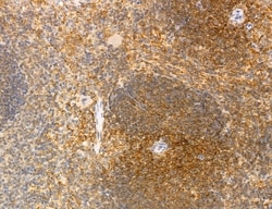 Invitrogen Phospho-WASP (Tyr291) Polyclonal Antibody 100 &mu;L; Unconjugated:Antibodies,