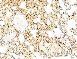 Invitrogen Phospho-WASP (Tyr291) Polyclonal Antibody 100 &mu;L; Unconjugated:Antibodies,