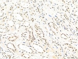 Invitrogen Phospho-WASP (Tyr291) Polyclonal Antibody 100 &mu;L; Unconjugated:Antibodies,