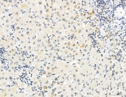 Invitrogen Phospho-WASP (Tyr291) Polyclonal Antibody 100 &mu;L; Unconjugated:Antibodies,