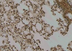 Invitrogen Phospho-MAPKAPK2 (Thr221, Thr222) Polyclonal Antibody 100 μL;
