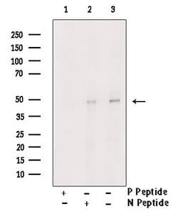 Invitrogen Phospho-MAPKAPK2 (Thr221, Thr222) Polyclonal Antibody 100 μL;