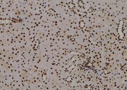 Invitrogen Phospho-C/EBP alpha (Thr226) Polyclonal Antibody 100 &mu;L;