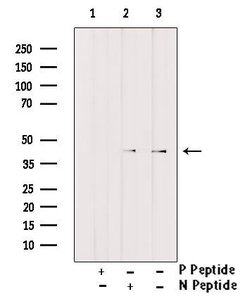 Invitrogen Phospho-C/EBP alpha (Thr226) Polyclonal Antibody 100 &mu;L;