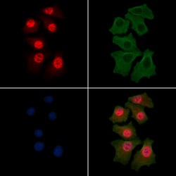 Invitrogen Phospho-CDK7 (Ser164) Polyclonal Antibody 100 &mu;L; Unconjugated:Antibodies,