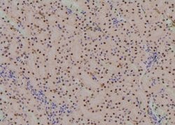 Invitrogen Phospho-CDK7 (Ser164) Polyclonal Antibody 100 &mu;L; Unconjugated:Antibodies,