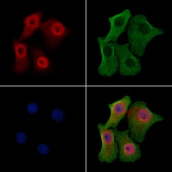 Invitrogen Phospho-BRCA2 (Ser2095) Polyclonal Antibody 100 μL; Unconjugated:Antibodies,