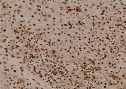 Invitrogen Phospho-BRCA2 (Ser2095) Polyclonal Antibody 100 μL; Unconjugated:Antibodies,
