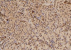Invitrogen Phospho-RSK2 (Thr577) Polyclonal Antibody 100 &mu;L; Unconjugated:Antibodies,