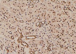 Invitrogen Phospho-RSK2 (Thr577) Polyclonal Antibody 100 &mu;L; Unconjugated:Antibodies,