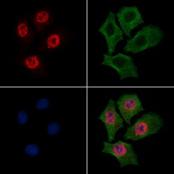 Invitrogen Phospho-RSK2 (Thr577) Polyclonal Antibody 100 &mu;L; Unconjugated:Antibodies,