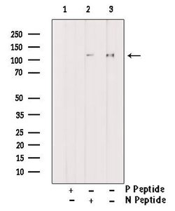 Phospho-ATP Citrate Lyase (Ser447) Polyclonal Antibody, Invitrogen 100