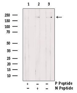 Phospho-Afadin (Tyr1230) Polyclonal Antibody:Antibodies, Polyclonal