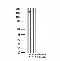 Phospho-Afadin (Tyr1230) Polyclonal Antibody:Antibodies, Polyclonal