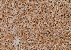 Invitrogen Phospho-p130Cas (Tyr267) Polyclonal Antibody 100 μL; Unconjugated:Antibodies,