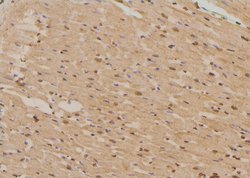 Invitrogen Phospho-p130Cas (Tyr267) Polyclonal Antibody 100 μL; Unconjugated:Antibodies,