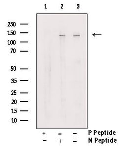 Invitrogen Phospho-p130Cas (Tyr387) Polyclonal Antibody 100 μL; Unconjugated:Antibodies,