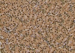 Invitrogen Phospho-RHOA (Thr100) Polyclonal Antibody 100 &mu;L | Buy Online | Invitrogen&trade; | Fisher Scientific