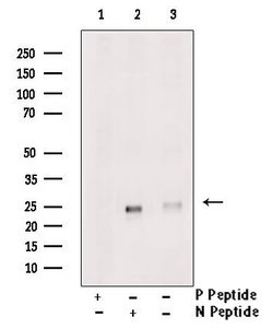 Invitrogen Phospho-RHOA (Thr100) Polyclonal Antibody 100 &mu;L | Buy Online | Invitrogen&trade; | Fisher Scientific