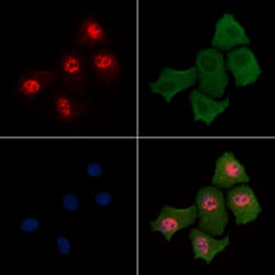 Invitrogen Phospho-Histone H3 (Ser58) Polyclonal Antibody 100 &mu;L | Buy Online | Invitrogen&trade; | Fisher Scientific